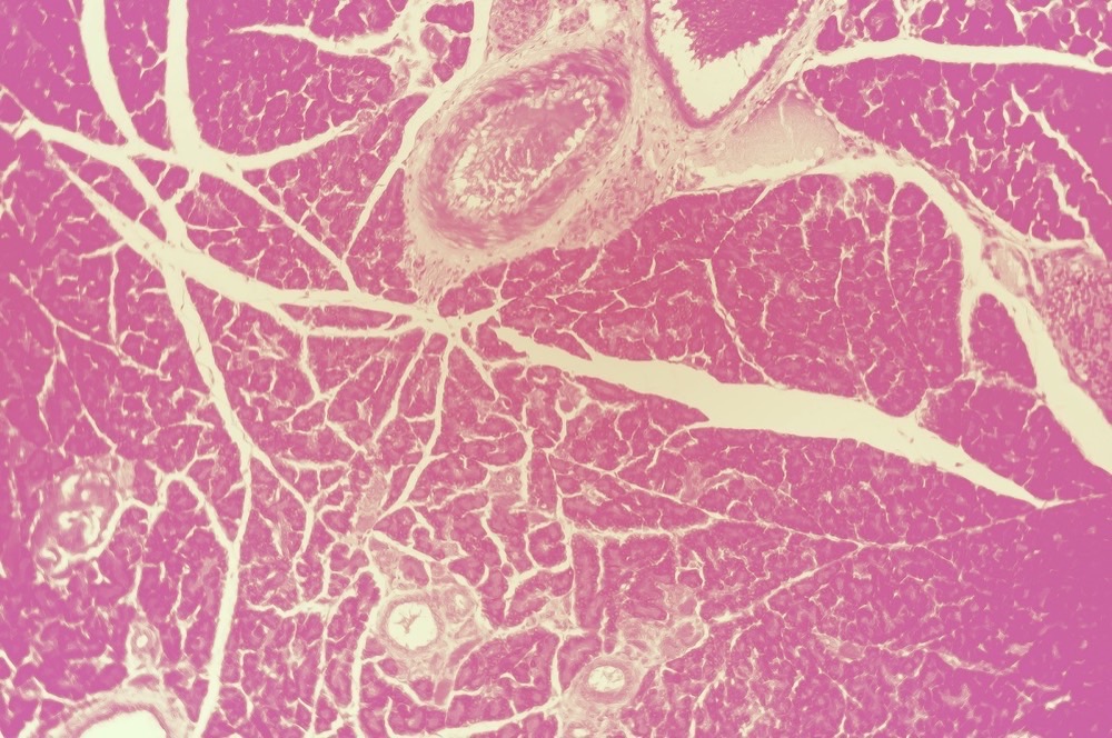 University Press of Colorado - Beautiful Flesh